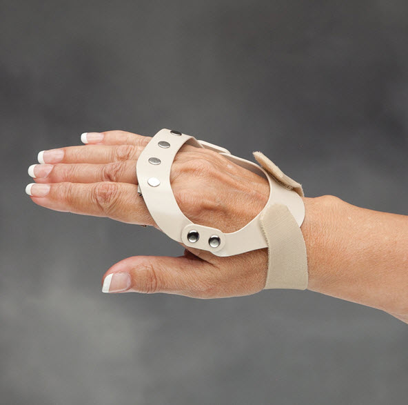 ThreePoint Polycentric Hinged Ulnar Deviation Splint